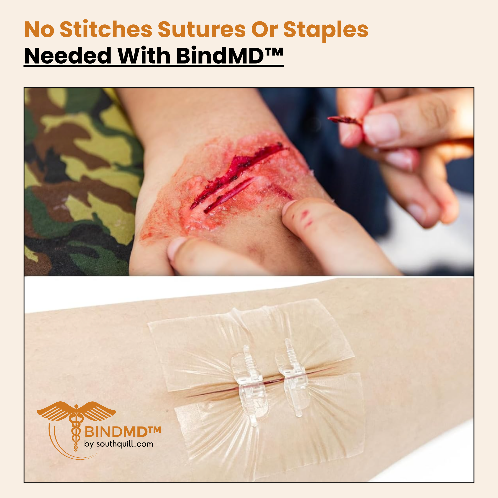 BindMD™ Wound Bandage